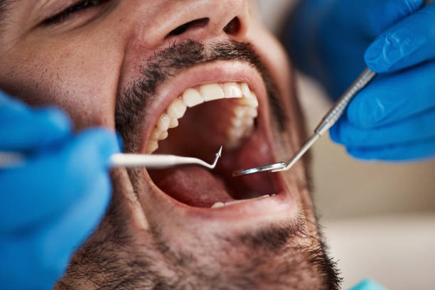 Best Emergency Treatment for Dental Infections or Abscesses in Ottawa, OH